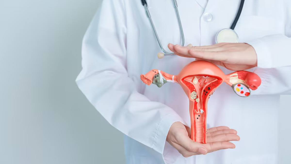 Why You Should Take Vitamin D For Managing PCOS? Here’s What Doctor Recommends